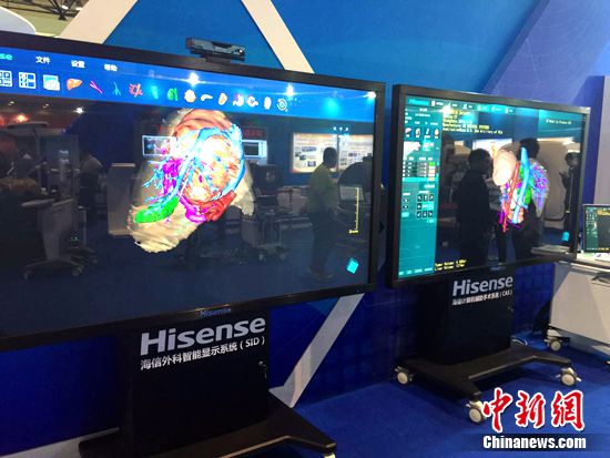 ����CASӋ��C�o�����gϵ�y