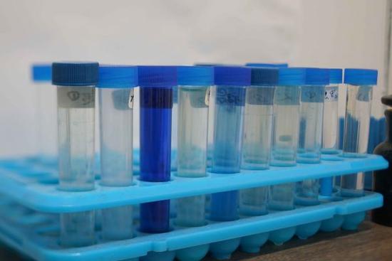 百草枯病人灌流前的尿液 攝影:vict