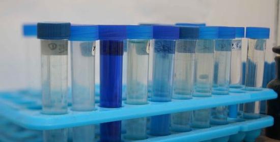 經濟觀察報 記者 王雅潔李德軍,中國百草枯之父,現為山東省農藥科學研究院院長、黨委書記。在他的記憶里,多年前攻克下英國壟斷的百草枯生產工藝技術課題時的挑戰難以磨滅。在他的職業生涯里,因為百草枯,將他推上事業頂峰,同樣也因為百草枯,給他帶來輿論上的重重壓力。