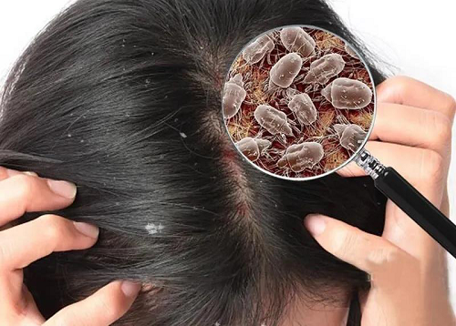 美神床墊:頭發越掉越多?別慌!可能是螨蟲在作怪!(圖4)