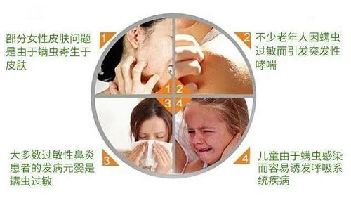 美神床墊:頭發越掉越多?別慌!可能是螨蟲在作怪!(圖5)